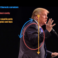 Sniffgate 2016: Why Donald Trump Can’t Breathe Properly